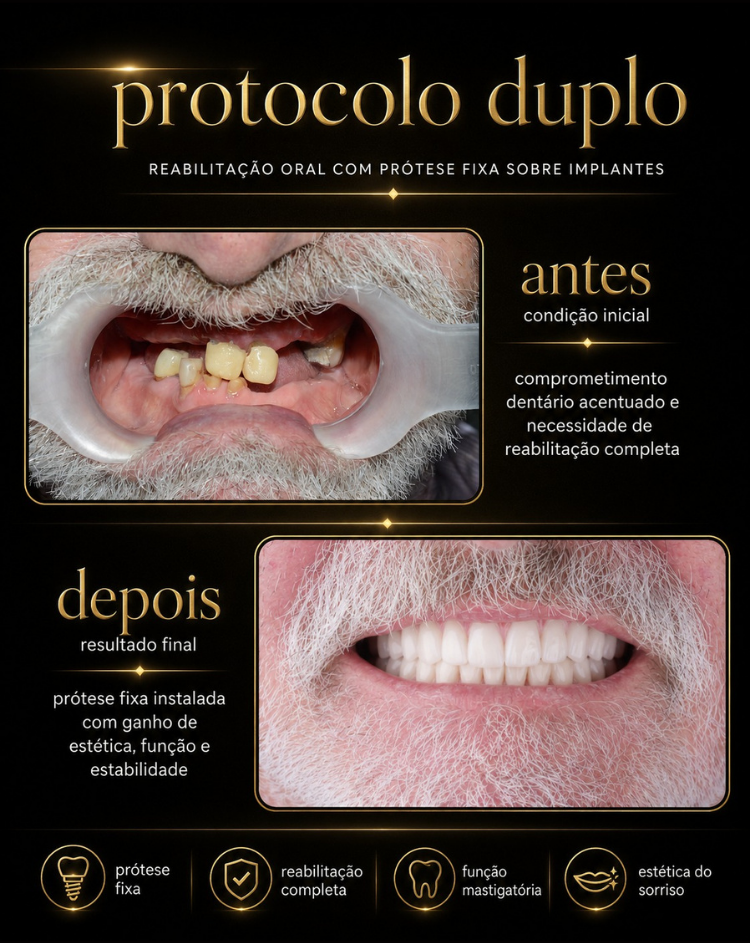Casos Clínicos de Implantes RiT Odontologia 05