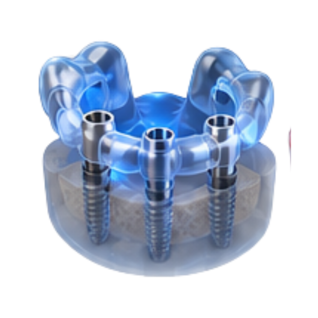 Cirurgia Guiada RiT Odontologia